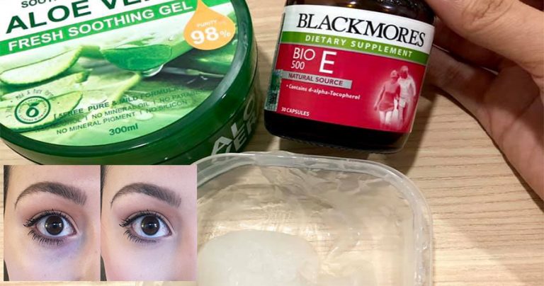 Buat Sendiri Serum Atasi Masalah Dark Circle Yang Liat Nak Hilang