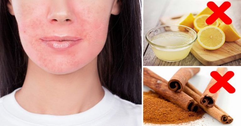 Kalau Ada Petua Cantik Guna 7 Bahan Ini, Jangan Ikut. Tak Selamat Untuk Kulit Wajah