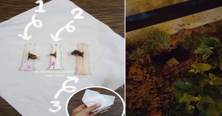 Dah 5 Tahun Baru Sedar Kesilapan Simpan Tali Pusat Anak, Ini Sebenarnya Yang Patut Ibu Bapa Lakukan