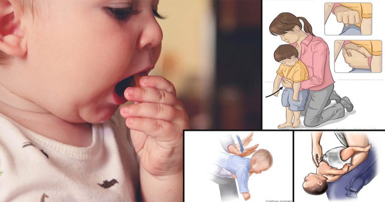 Selamatkan Anak Jika Tercekik, Ibu Bapa & Pengasuh Perlu Mahir Teknik Manuver Heimlich