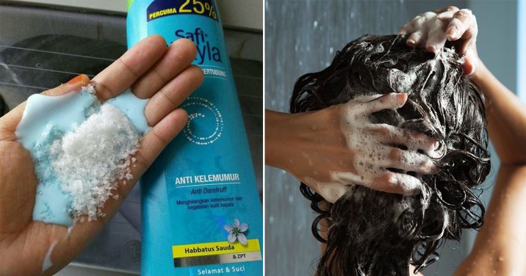Campur Bahan Ini Waktu Bersyampu, Petua Berkesan Atasi Rambut Gugur, Gatal & Kelemumur