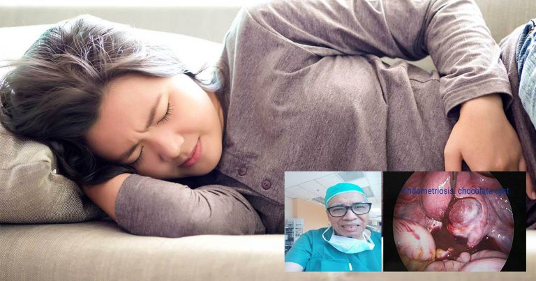 8 Tanda Penyakit Endometriosis Perlu Diawasi Wanita Muda Sebelum Jejas Kesuburan, Rosakkan Peranakan