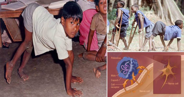Kembali Selepas 27 Tahun, Ibu Bapa Perlu Alert 6 Perkara Tentang Ancaman Polio
