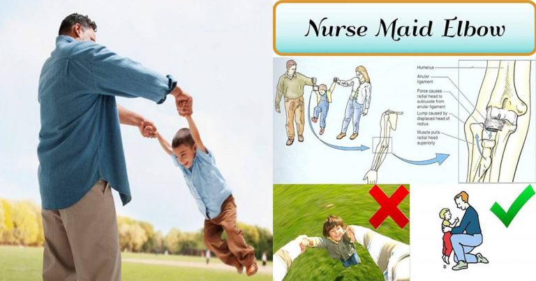 Jangan Biasakan Hayun Tangan Anak Usia Bawah 5 Tahun. Tulang Mereka Lembut, Boleh Kena Nursemaid Elbow
