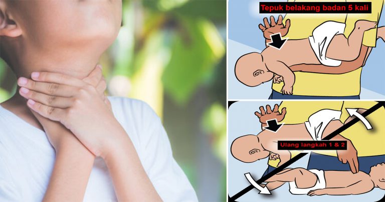 Selamatkan Nyawa Anak Jika Tercekik Makanan, Ibu Bapa Kena Belajar Teknik Heimlich