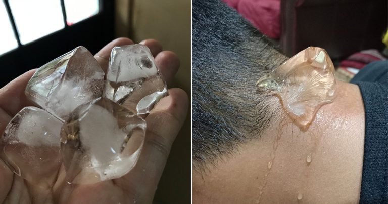 Guna Ketulan Ais Cara Mudah Tapi Berkesan Redakan Migrain