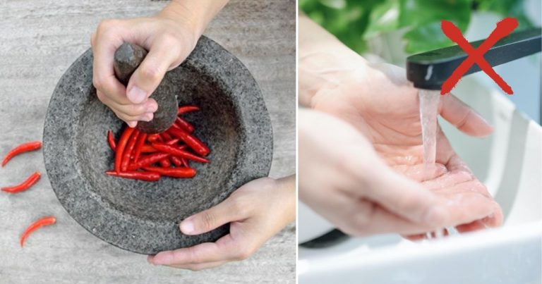 Jangan Basuh Dengan Air Jika Tangan Pijar, Doktor Ini Kongsi Cara Betul Hilangkannya