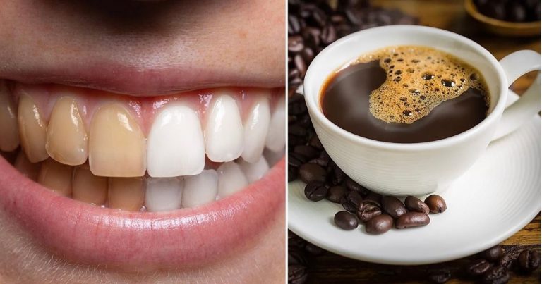 Kalau Suka Minum Kopi, Doktor Gigi Nasihat Ikut 7 Tip Ini Supaya Gigi Tak Kuning Dan Sensitif