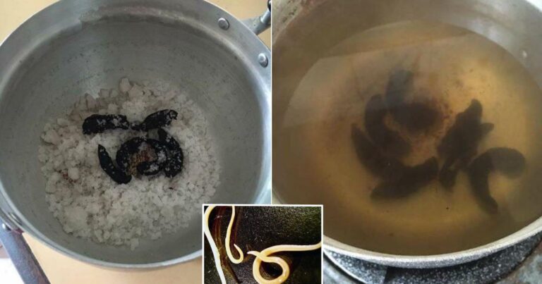 Petua Atasi Masalah Cacing Pada Anak Jika Susah Makan Ubat, Mandi Dengan Air Ini