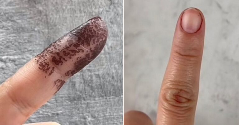 Cara Mudah Tanggalkan Dakwat Mengundi Yang Dah Berkeruping, Tak Sampai 10 Minit Dah Bersih