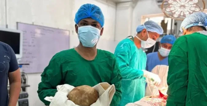 Sukar Kencing Bertahun-Tahun, Doktor Temui Batu 3.1kg Dalam Pundi Kencing Lelaki Ini 5 Sukar Kencing Bertahun-Tahun, Doktor Temui Batu 3.1kg Dalam Pundi Kencing Lelaki Ini