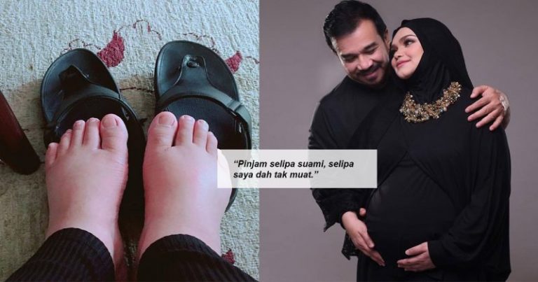 Kalau Namanya Datuk Siti Nurhaliza, Kaki Bengkak Pun Jadi Perhatian. Netizen Beri Komen Lucu, Ramai Kata Kaki Tu Nampak Comel !