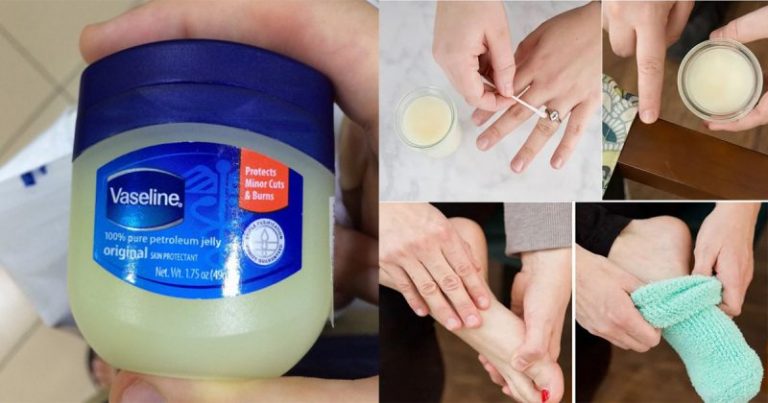 25 Kegunaan Luar Biasa Petroleum Jelly Selain Sapu Pada Kulit Kering. Rugi Kalau Biar Expired