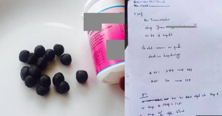 Luar Nampak Segar Bugar Tapi Dalaman Rosak! 3 Tahun Amal Maajun, Wanita Ini Disyaki Hidap Radang Hati