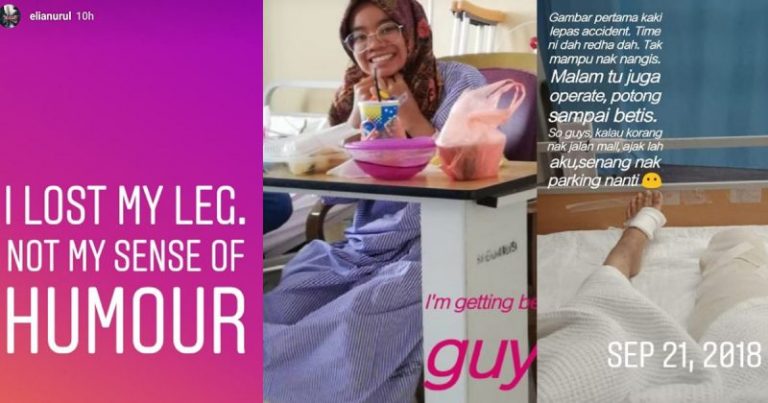 Terpelanting 2 Meter, Kaki Putus Tapi Semangat Gadis Ini Buat Ramai Kagum. Punyalah Tenang Siap Boleh Buat Lawak Lagi