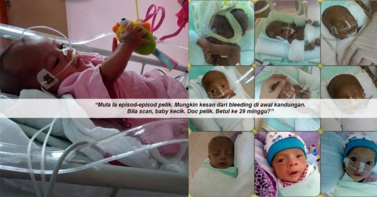 ‘Anak Akak Lahir Sebesar Tapak Tangan’. Pengalaman Wanita Ini Jadi Pengajaran Untuk Ibu Hamil, Kalau Penat Jangan Paksa Diri Buat Kerja!