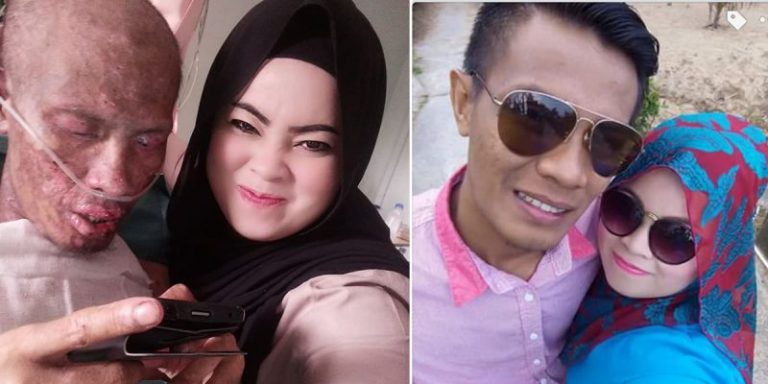 ‘Seburuk Mana Pun Wajah Suami, Saya Takkan Tinggalkan Dia’, Hebatnya Kasih Nurr Hidayah!