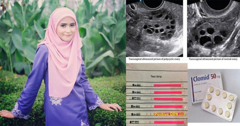 Wanita Ini Kongsi Pelbagai Cara Dilakukan Untuk Dapat Cahaya Mata Terutama Untuk Jenis Haid Tak Teratur