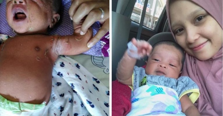 Ummi Sampai Sekarang Fobia, Bayi Baru Lahir Antibodi Tak Kuat. Ibu Ini Kongsi Kisah Anak Kena Jangkitan Kulit