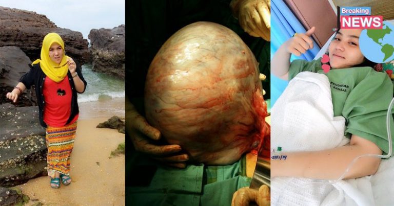Dituduh Hamil Waktu Belajar Rupa-rupanya Gadis Ini Usung Cyst 12KG!