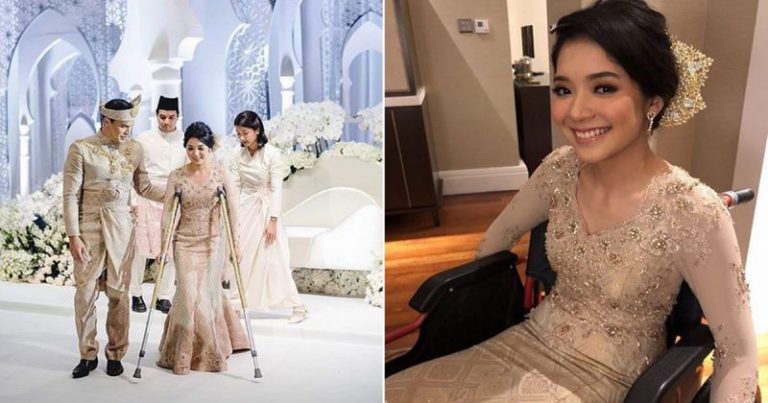 Pengantin Cantik Bertongkat! Rupanya Cedera Kerana Selamatkan Kucing