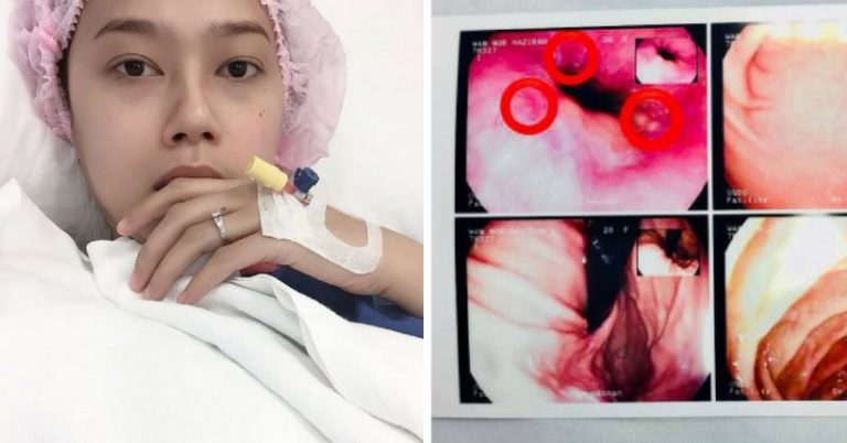 10 Tahun Amal Makan Pedas, Gadis Ini Berdepan Risiko Kanser. Akibatnya Kini Terpaksa Berpantang & Bergantung Pada Ubat