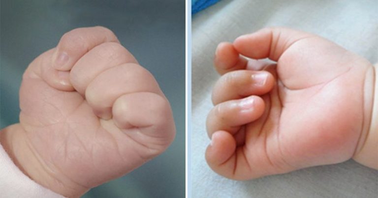 7 Pergerakan Bayi Yang menandakan Ada Sesuatu Tak Kena!