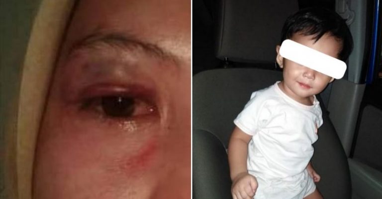 Hajat Nak Bercinta Selepas Nikah Tapi Patah Hidung Dipukul Suami, Wanita Ini Tekad Hidup Sendiri