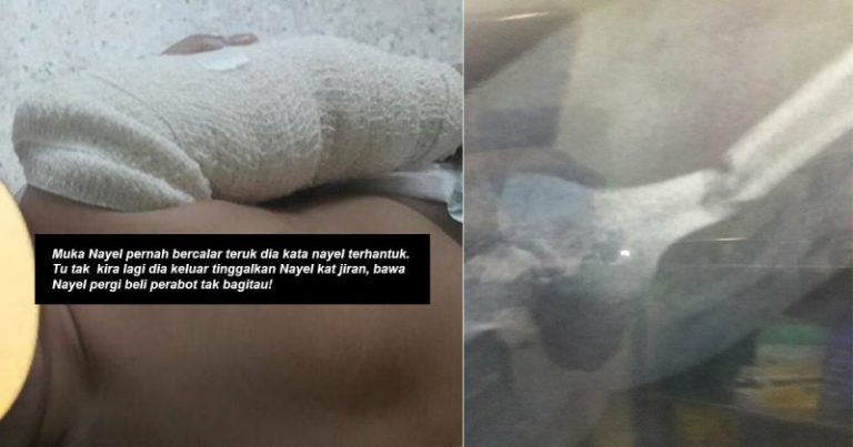 ‘Tangan Nayel Terkulai Lepas Ambil Dari Rumah Pengasuh!’ Doktor Sahkan Akibat Dipijak Atau Dipukul