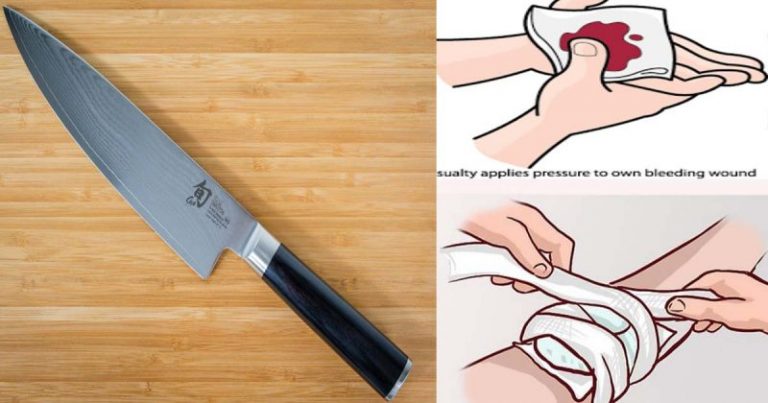 Jangan Cabut Pisau! Lakukan 7 Langkah Ini Jika Tertusuk Objek Tajam