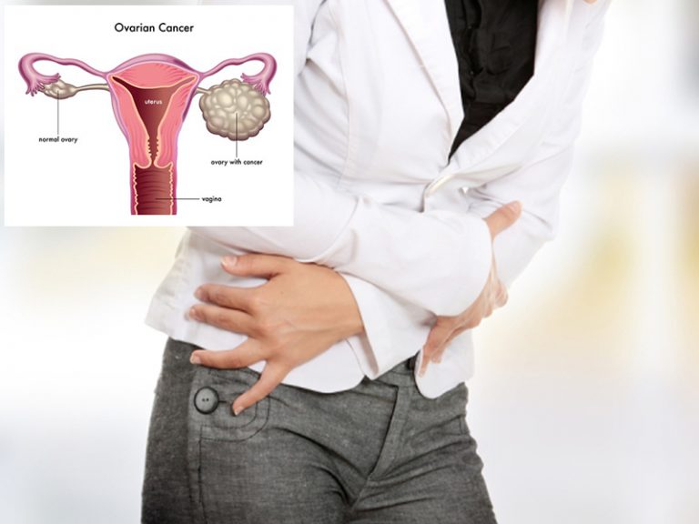 7 Petanda Awal Kanser Ovari Yang Sering Dianggap Masalah Biasa Oleh Wanita