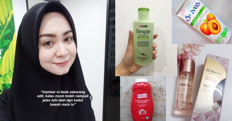 Gadis Cantik Ini Kongsi Rahsia Miliki Kulit Flawless Hanya Guna Produk Dari Farmasi Biasa Saja Tapi Hasilnya…