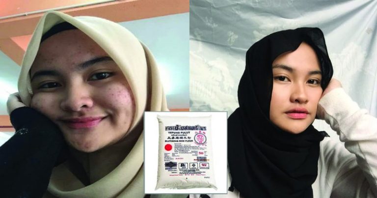 Kulit Breakout Jadi Flawless Dalam Masa 3 Bulan Selepas Amal Masker Tepung Pulut Petua Nenek
