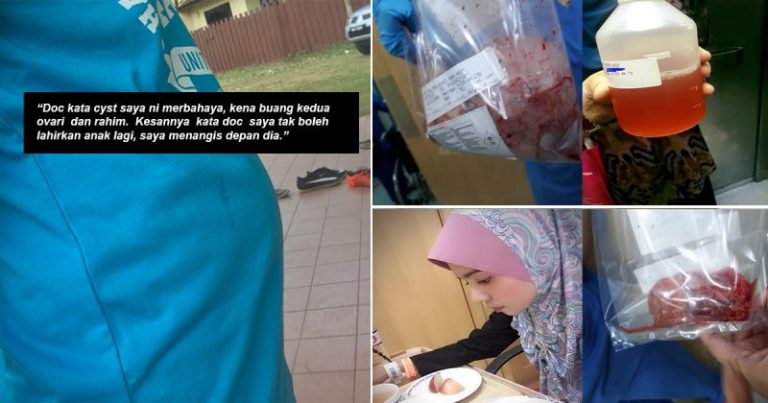 Perut Macam Hamil 4 Bulan Jadi Tanda, Wanita Ini Kongsi Detik Pilu Dibuang Ovari & Rahim Akibat Cyst
