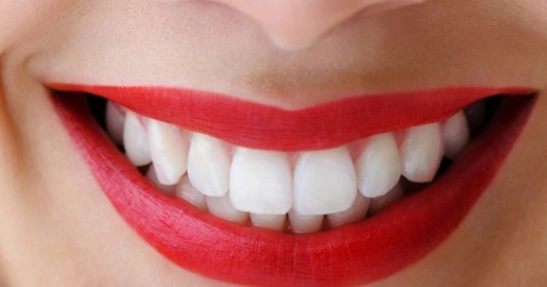 5 Cara Hapuskan Plak Gigi, Guna Bahan Dari Dapur Saja